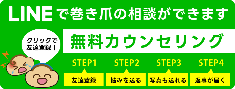 札幌巻き爪センターへLINEで無料相談